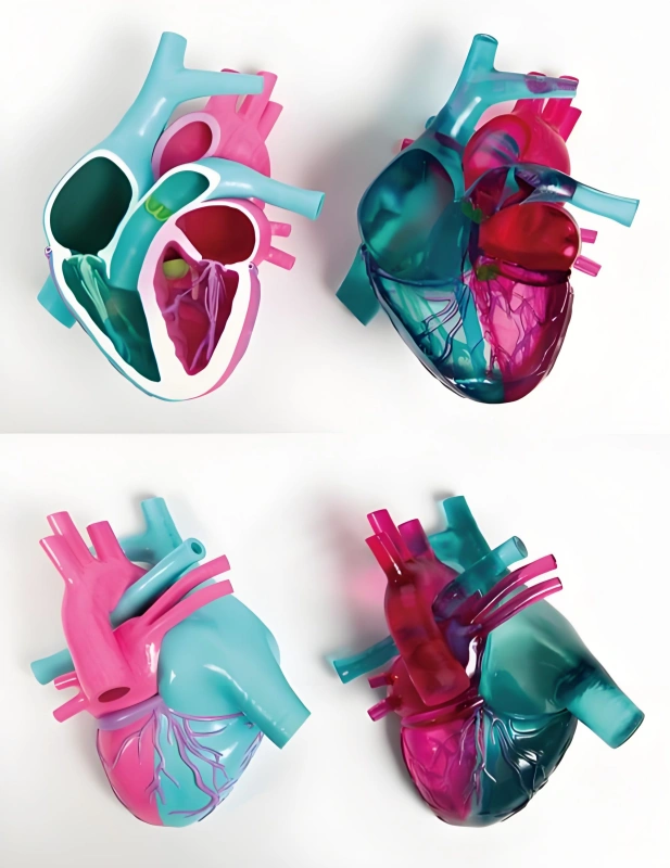 3D Printed Medical Teaching Model